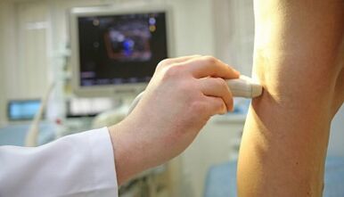 Laser treatment against varicose veins